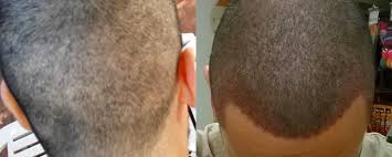 A hurricane and marketing woes couldn't keep these persistent franchisees down. Vademecum Post Trapianto Di Capelli Fue Firstduty E Mayhemag