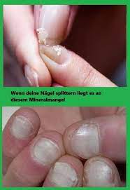 wenn deine nagel splittern liegt es an diesem mineralmangel nagel gesudheit tipp tipps gesundheit abnehmen pinterest mineralien schonheitstricks vitamine und mineralien