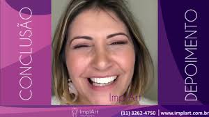 DEPOIMENTO CONCLUSÃO DE TRATAMENTO IMPLANTE TOTAL PRÓTESE ZIRCONIA  @ImplArtImplanteseestetica