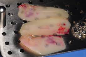 Prf membranes to solve your problems related to water seepage. Platelet Rich Fibrin Prf Platelet Rich Fibrin Prf Kazemi Oral Surgery Facialart Com