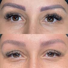 Prezamos por procedimento natural!