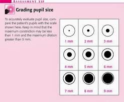 Pupil Size Chart In Neuro Success Nursing School Notes