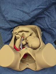 Image result for Shoulder Presentation