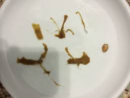 We did not find results for: Parasite Or Roughage In Bowel Movement What S That Bug