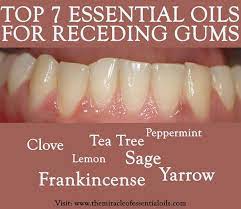 Grow Back Gums With Essential Oils For Receding Gums The Miracle Of Essential Oils Recipe In 2021 Receding Gums Essential Oils For Colds Gum Care