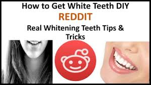 White spots is the most commonly used phrase to describe an area of the tooth surface that is as with braces causing demineralization, the white spots are areas where early decay has healed. How To Get White Teeth Diy Reddit Real Whitening Teeth Tips Tricks Youtube