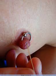 乳头穿刺 酷刑 挑战 极限