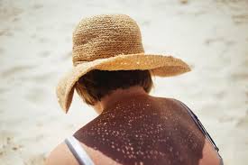 Image result for Sun Exposure