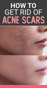 Pin On Baking Soda And Purple Shampoo