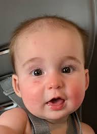 Overcapacity warning preceded 6-month-old's serious injury at Iowa day care