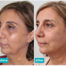 The Best 10 Plastic Surgeons near Joseph Dinglasan