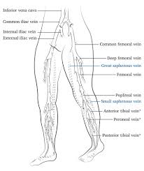 Editors Choice – European Society for Vascular Surgery (ESVS) 2022  Clinical Practice Guidelines on the Management of Chronic Venous Disease of  the Lower Limbs - European Journal of Vascular and Endovascular Surgery