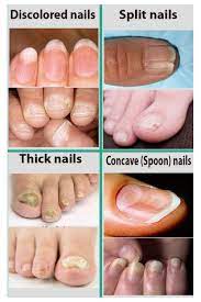 Tips For Nail And Tongue Health Health Care Brittle Toenails Healthy Nails Toe Nails