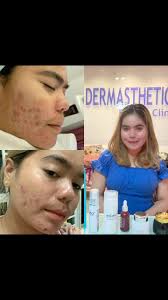 Pilih lah rawatan dan Skincare yang btl untuk kulit anda ❤️  #eadadermasthetics #dermatology #pigmentation #acnetreatment