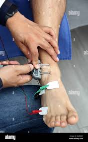Image result for Nerve Conduction Velocity