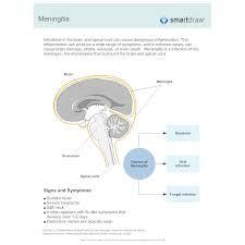 meningitis