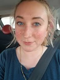 Meghan Markle's Freckles Inspire Women to Get Faux Freckle Tattoos