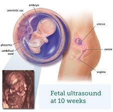 Find out how your baby is developing in week ten of your pregnancy. Fetal Ultrasound 2 Months Babycentre Uk