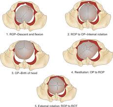 Image result for Manual Rotation in Occipitoposterior Presentation