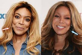 For a little breakfast procedure, williams said, before showing a clip of her cosmetic surgeon, dr. Wendy Williams Before And After Plastic Surgeries Plasticsurgerypro Info