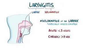 Image result for Acute Laryngitis