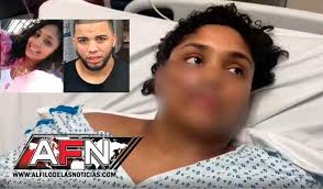 Dominicana atacada por ex pareja confirma le retiró orden de alejamiento  porque “actuaba normal”