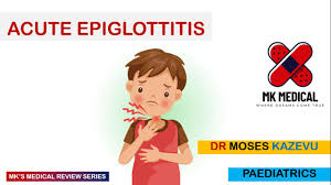 Image result for Epiglottitis