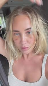 1 week post blepharoplasty and eyebrow lift. , Surgery was done in Phuket.,  It’s healing really well and I’m happy with the results so far. 🙌🏽