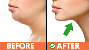 How to reduce cheek fats within a week? How To Get Rid Of Double Chin Naturally 10 Exercises Trabeauli By Trabeauli Medium