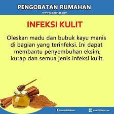 Pengobatan Rumahan Kesehatan Obat Alami Resep Sehat Kesehatan