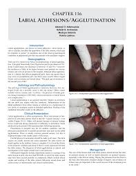 Image result for Labial Fusion