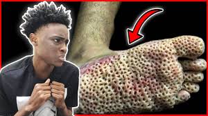 A hamburger before the processing. Download Try Not To Look Away The Impossible Trypophob