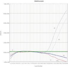 Kpk dari 36 dan 48 adalah 2⁴ x 3² = 16 x 9 = 144. Outbreak Of Crimean Congo Haemorrhagic Fever With Atypical Clinical Presentation In The Karak District Of Khyber Pakhtunkhwa Pakistan Infectious Diseases Of Poverty Full Text