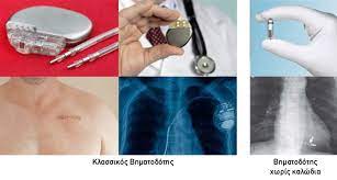 Τα αντιπηκτικα sintrom και noacs (pradaxa, xarelto, eliquis), η εγχειρηση και η. Bhmatodoths Eurocardio