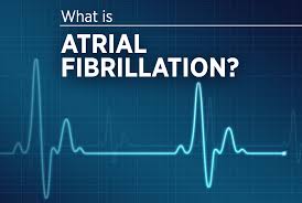 Image result for Atrial Fibrillation
