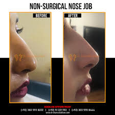 The entire procedure was filmed for plastic on mixed makeup, and a ton of people left comments. Nosetip Hashtag On Twitter