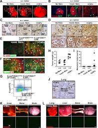 I suspect that the error is actually related to how you are cleaning up, particularly when you say kill all related processes. Stromal Fibroblasts Induce Metastatic Tumor Cell Clusters Via Epithelial Mesenchymal Plasticity Life Science Alliance