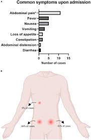Image result for Diverticulitis
