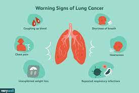 Introduction to cancer symptoms and signs. Is My Cough A Lung Cancer Cough