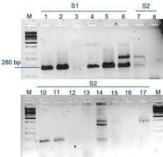 Figure Legends Figure 1 Agarose Gel Electrophoresis 2 Agarose Of Download Scientific Diagram