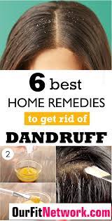 With the winter season approaching, your scalp tends to get extremely dry and flaky! 6 Best Home Remedies To Get Rid Of Dandruff For Good In 2021 Home Remedies For Dandruff Dandruff Remedy Getting Rid Of Dandruff