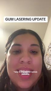 Why Is The Dennis Laser in My Gums