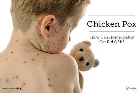 People should look for specific ingredients, such as retinol and glycolic acid, which are common in products for acne. Chickenpox Tips Advice From Top Doctors Lybrate