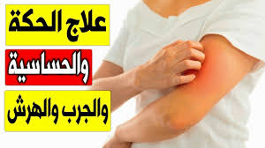 علاج الحكة الجلدية علاج الجرب والهرش طريقة علاج الحساسيه والحكه في ا Playbill