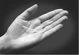 How long did everyone else have to wait before they got their period after nexplanon implant removal ? Nexplanon Fda Prescribing Information Side Effects And Uses