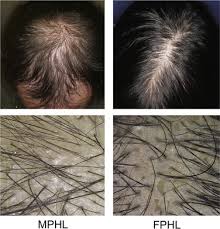 Alibaba.com offers 20,559 hair gel color products. Strategies To Utilize Ips Cells For Hair Follicle Regeneration And The Treatment Of Hair Loss Disorders Sciencedirect