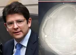 El incidente en Colombia evidencia los peligros del odio en la política.  Que sirva como ejemplo para la candidata oficialista del gobierno de Libre  Rixi Moncada. ¡Honduras merece campañas de propuestas y