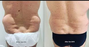 Newlife aesthetics is at raynes park, london. Newlife Aesthetics In Cottenham Park