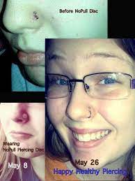 It S Not Like They Won T Notice A Bump On Your Piercing It S Hypertrophic Scarring Common Very Stubborn Nose Piercing Bump Nose Piercing Tips Piercing Bump