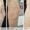 Laser hair removal is quickly becoming a popular choice for women in ireland. 1